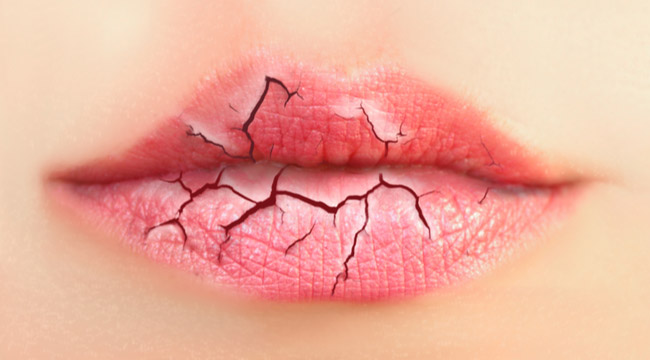 Woman with dry mouth