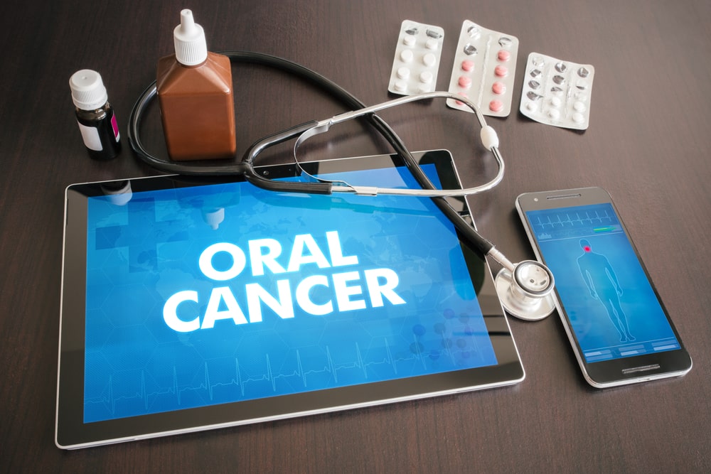 Oral Cancer Screening in Calgary